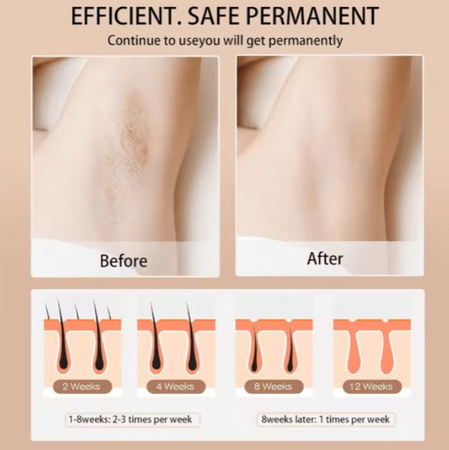 Babyverse - Digital IPL Hair Removal Device